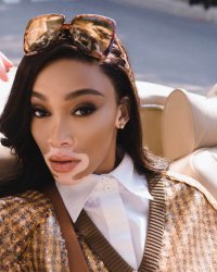 Les conseils beauté et forme de Winnie Harlow : "Rien de tel que la simplicité"