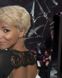 Shy'm confie avoir perdu une dent lors de sa fameuse chute à Bercy