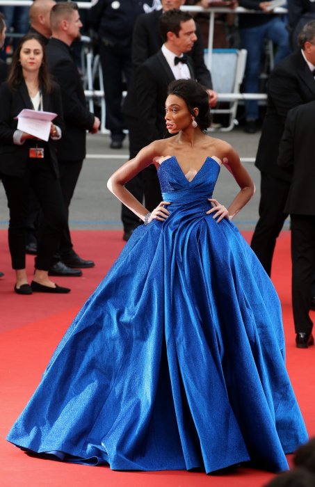 Winnie Harlow, la top model atteinte de Vitiligo enchante la Croisette Winnie Harlow, la top model atteinte de Vitiligo enchante la Croisette