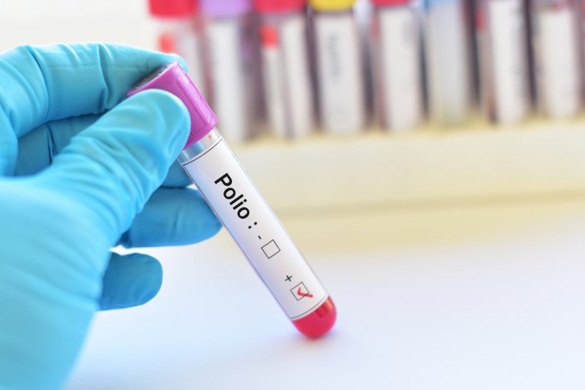 La polio, pas tout à fait éradiquée La polio, pas tout à fait éradiquée