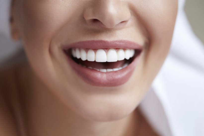 Votre sourire sera plus beau Votre sourire sera plus beau