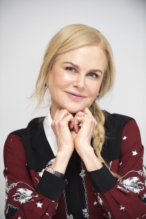 Nicole Kidman, accro au botox Nicole Kidman, accro au botox