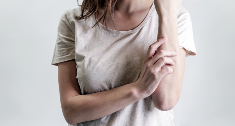 Le psoriasis Le psoriasis