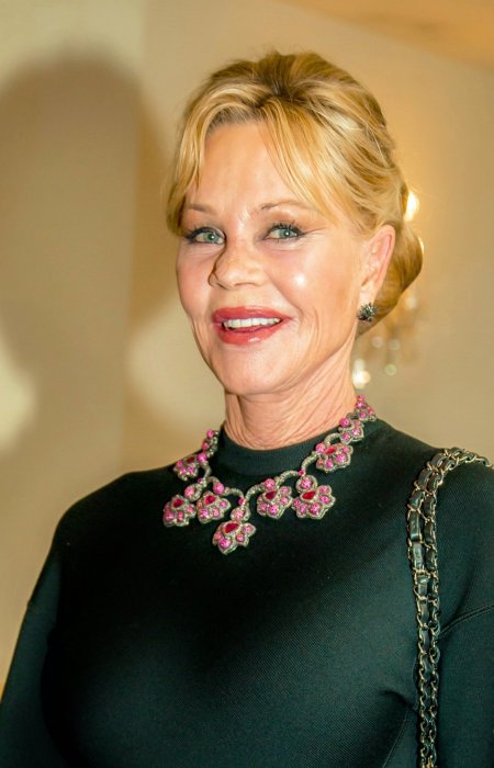 Melanie Griffith a renoncé à la chirurgie après une allergie Melanie Griffith a renoncé à la chirurgie après une allergie