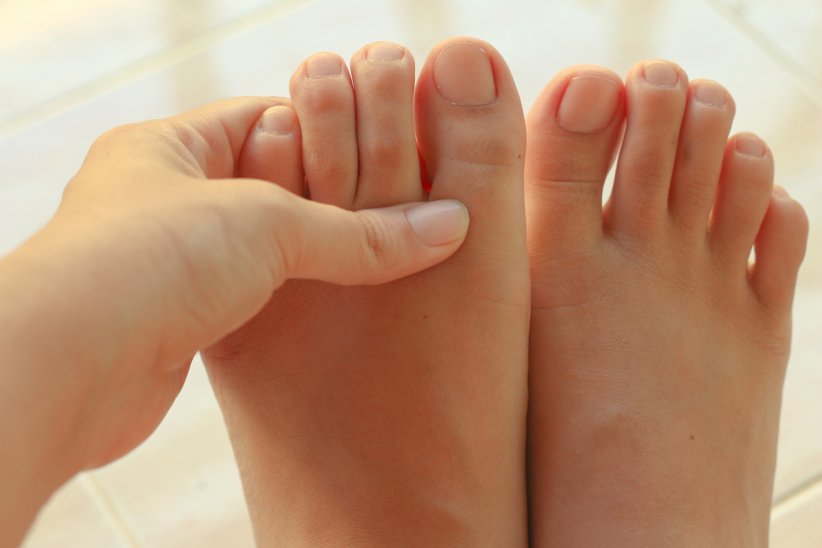 Les mycoses des ongles toucheraient le plus souvent le gros orteil Les mycoses des ongles toucheraient le plus souvent le gros orteil