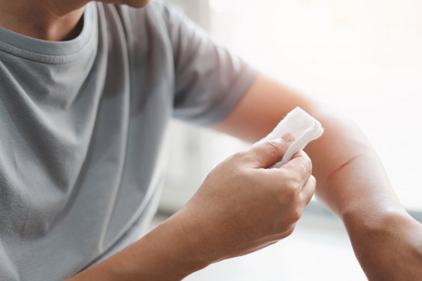 Une lésion qui saigne sans raison Une lésion qui saigne sans raison