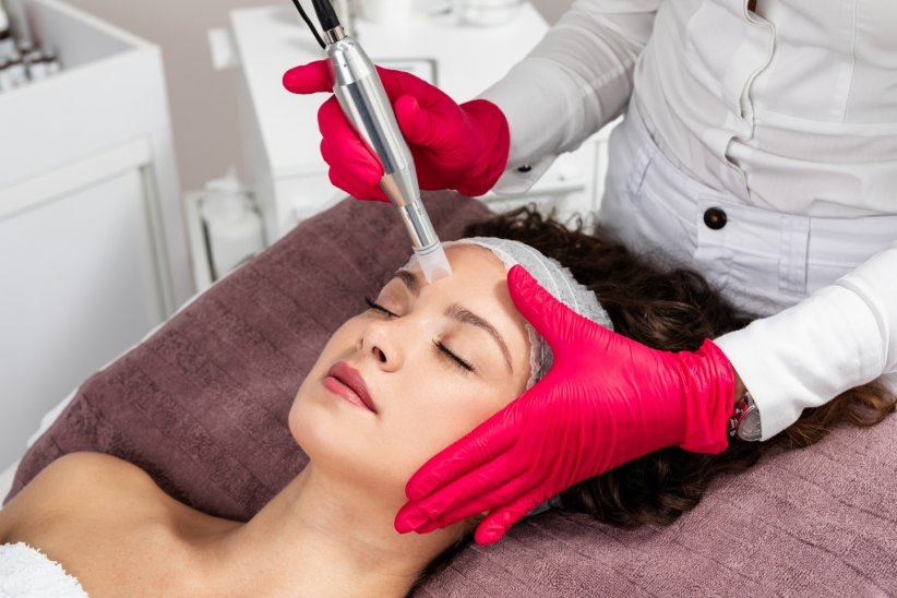 Le microneedling pour combattre les rides sans injections Le microneedling pour combattre les rides sans injections
