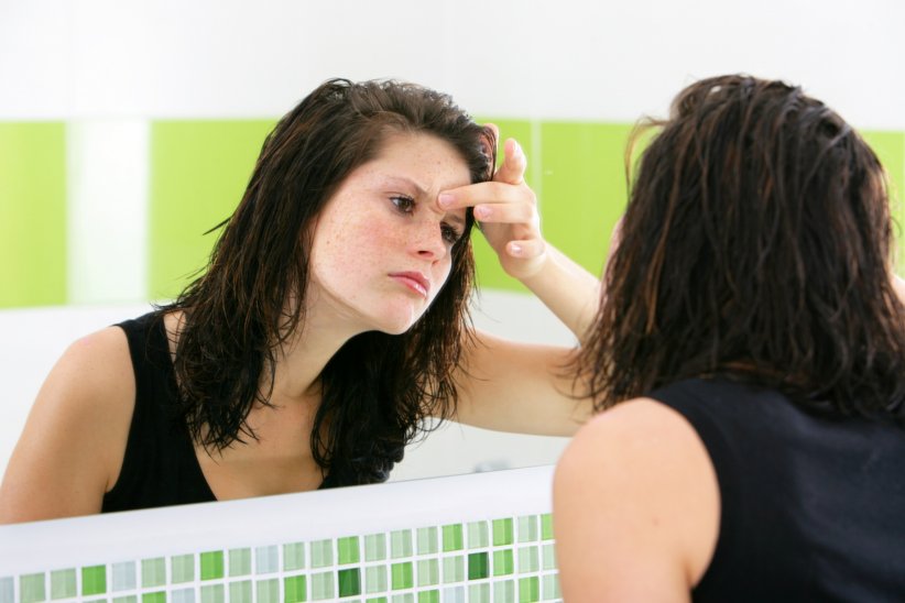Une peau plus grasse que d'habitude et des boutons plus présents Une peau plus grasse que d'habitude et des boutons plus présents
