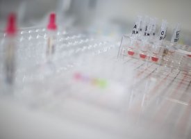 Noxxon : 10,7 ME de pertes en 2018 ; levée de fonds en vue