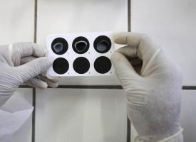 AB Science : présentation de nouvelles données pour la maladie de Charcot