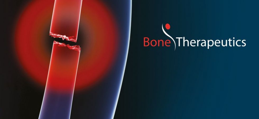 Bone Therapeutics : parmi les intervenants de la conférence virtuelle sur la croissance émergente organisée par M Vest LLC et Maxim Group LLC