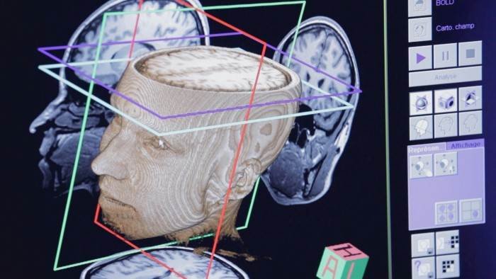 La fabrique du cerveau