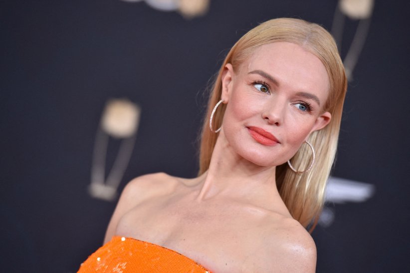 Kate Bosworth est atteinte d'hétérochromie partielle