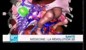 La semaine prochaine - Médecine : La révolution 3D