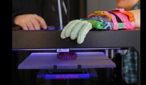 Cinq innovations médicales réalisées grâce à l'impression 3D