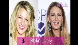 Vidéo : J.Lo, Jenifer, Blake Lively ... Elles ont eu recours à la rhinoplastie !