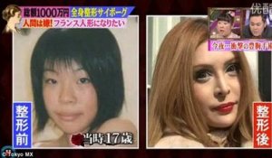 Cette Japonaise a dépensé 100.000 euros en chirurgie pour ressembler à une Française !