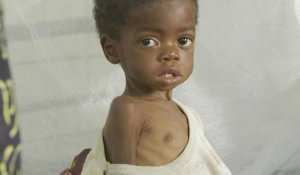 Au chevet des enfants mal-nourris du Kasaï, en RD Congo