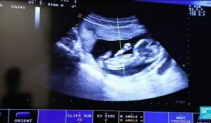 Loi contre l'avortement au Texas : la Cour suprême laisse en vigueur la loi très restrictive