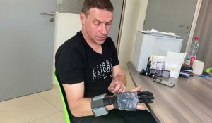 Amputé, il retrouve l'usage de sa main grâce à une prothèse posée à Méteren