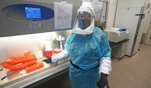 Espagne : deuxième décès d'un patient contaminé par la variole du singe