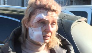 Ukraine: des habitants de Tchougouïv blessés après le bombardement d'un immeuble résidentiel
