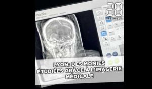 Lyon: Des momies étudiées grâce à l'imagerie médicale