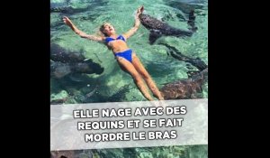 Elle voulait prendre une photo avec des requins pour Instagram, elle se fait mordre le bras