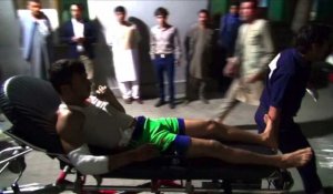 Au moins 20 morts à Kaboul: images à l'hôpital