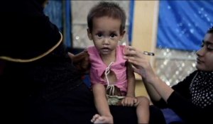 La malnutrition frappe des milliers d'enfants rohingyas