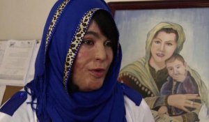 Défigurée par l'acide, Mumtaz l'Afghane vit dans la peur