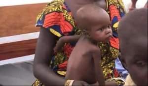 Plusieurs cas graves de malnutrition infantile à Bangui