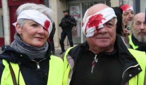 "Gilets jaunes": de faux blessés disent "stop au LBD" à Besançon
