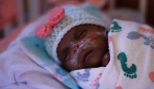 Californie: 245 grammes à la naissance, elle quitte l'hôpital 5 mois plus tard