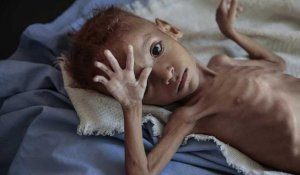 Yémen : l'ONU tire la sonnette d'alarme sur l'aide humanitaire