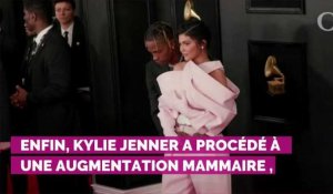 Kylie Jenner métamorphosée : ses opérations de chirurgie estimées à plus de 30 000 euros