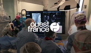 Santé. L'opération expérimentale au CHU de Rennes a sauvé le coeur de cette septuagénaire
