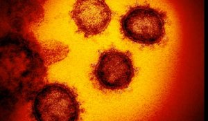 Covid-19 : 1 126 cas de contamination au coronavirus, PSG-Dortmund à huis clos, le point du 9 mars