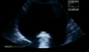 3D sex filmed by ultrasound camera?