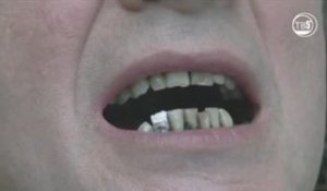 Fixing rotten teeth with a drill… The Russian way