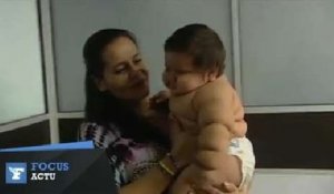 En Colombie, un bébé de 8 mois dépasse les 20 kilos