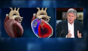 Cœur artificiel Carmat: le 2nd implanté a repris une "vie normale" explique Alain Ducardonnet