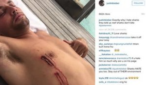 Un ami de Justin Bieber s'est fait mordre par un requin