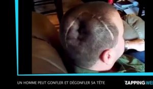 Un homme peut gonfler et dégonfler sa tête (vidéo)