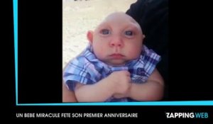 Malgré les pronostics des médecins, un bébé atteint d'une rare malformation fête son premier anniversaire