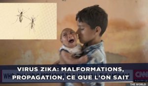 Virus zika: Malformations, propagation, ce que l'on sait