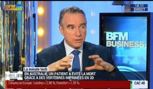 La Minute Tech: Un patient évite la mort grâce à des vertèbres imprimées en 3D - 25/02