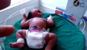 Bébé le plus lourd du monde : une Indienne accouche d'une petite fille pesant 6,8 kg