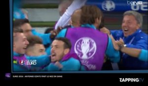 Euro 2016 : Belgique – Italie, Antonio Conte finit le nez en sang en célébrant le premier but italien (Vidéo)