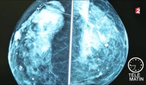 Santé - Lutter contre la récidive du cancer du sein